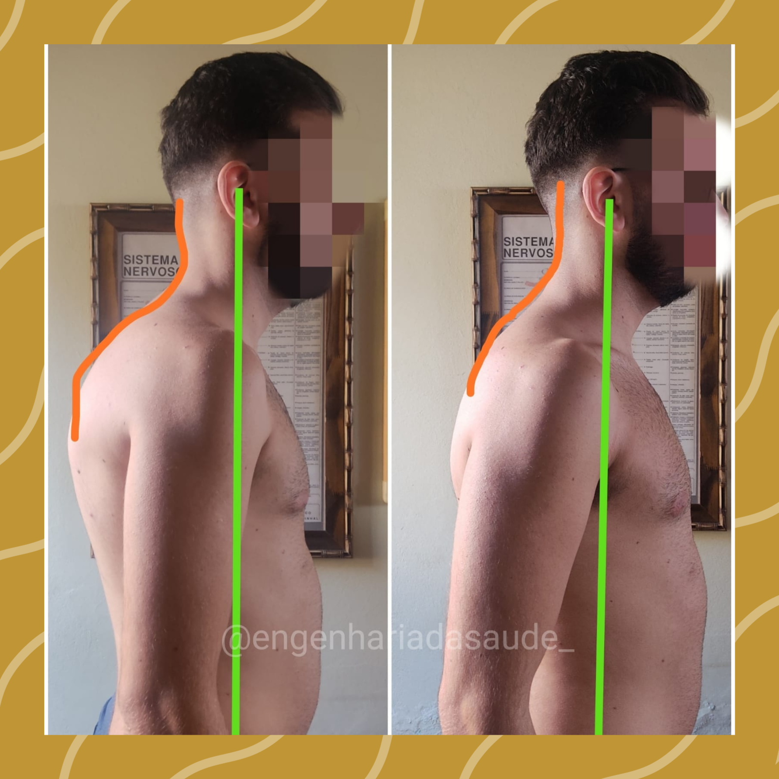 Quiropraxia em Natal RN