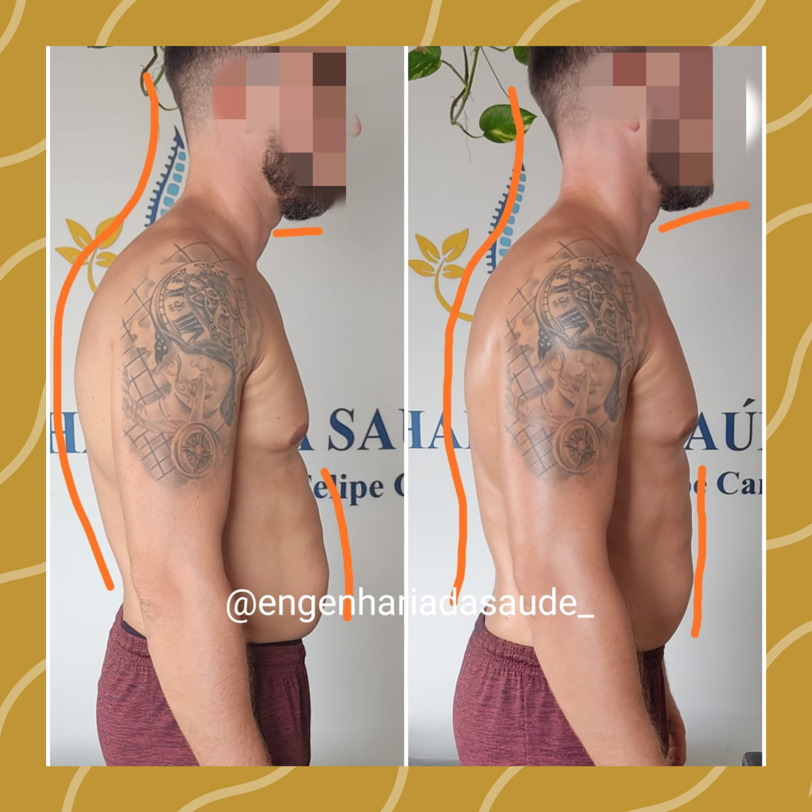 Quiropraxia em Natal RN