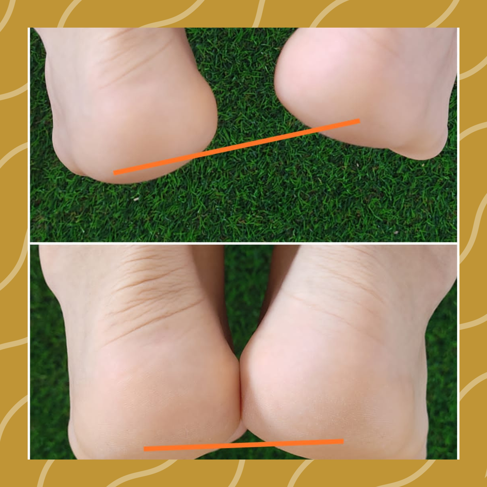 Quiropraxia em Natal RN