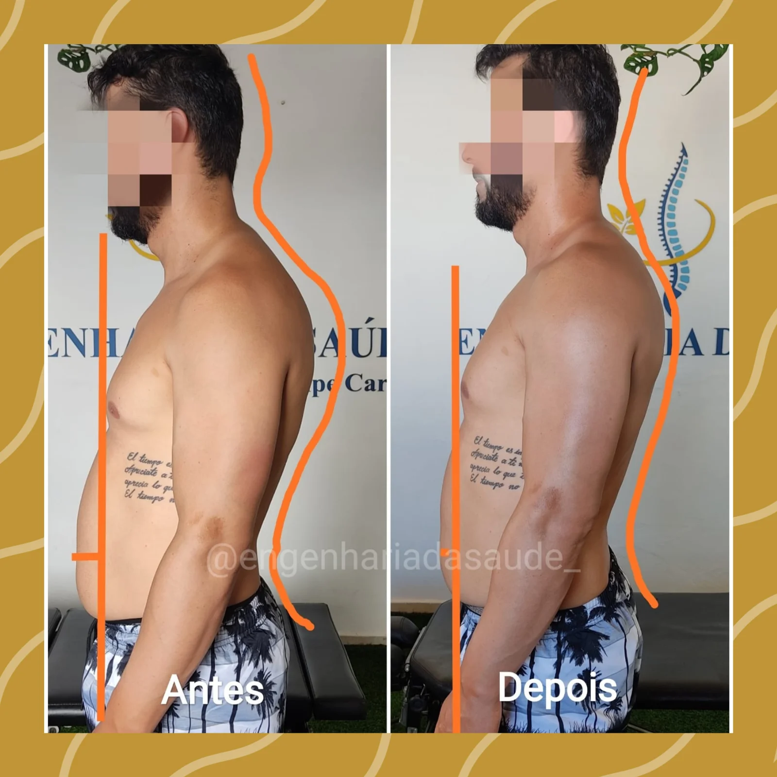 Tratamento para melhorar postura e dores