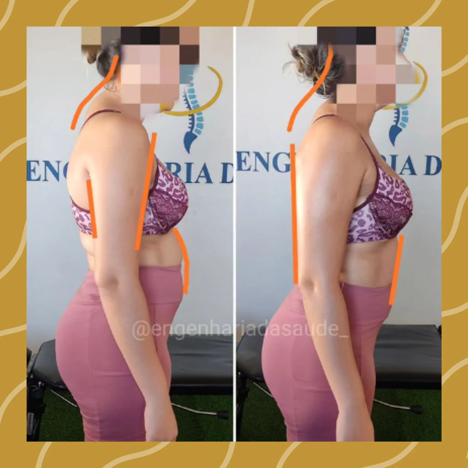Tratamento lombalgia